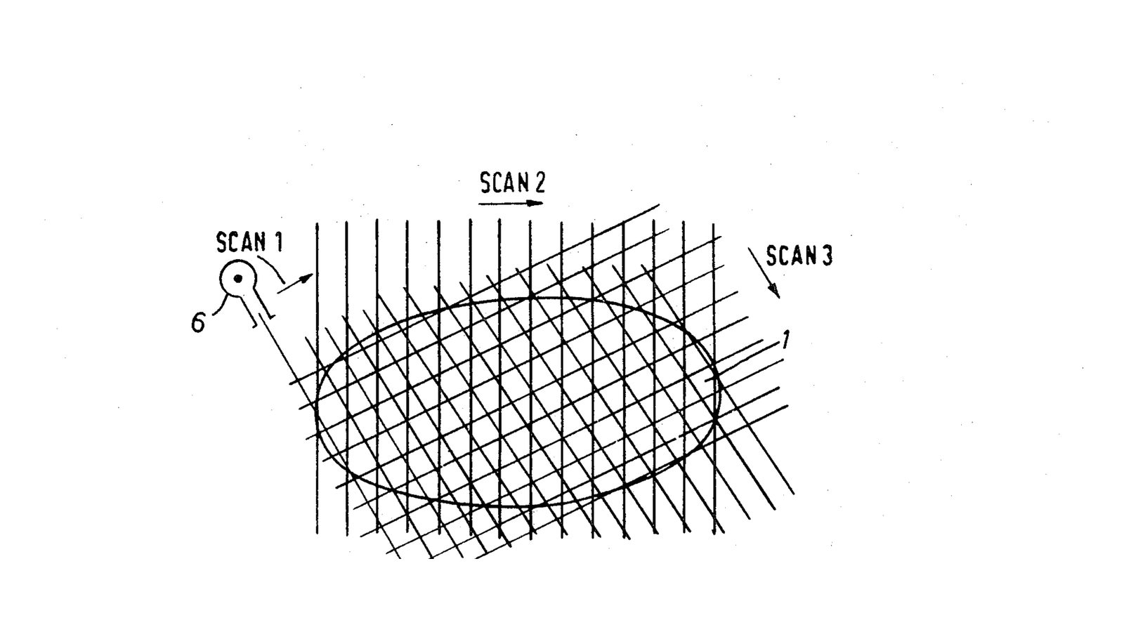 Hounsfield Computed Tomography