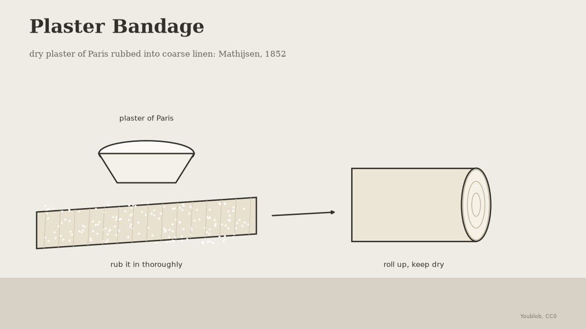 Plaster Bandage: Dry Plaster of Paris Rubbed into Coarse Linen, Mathijsen 1852