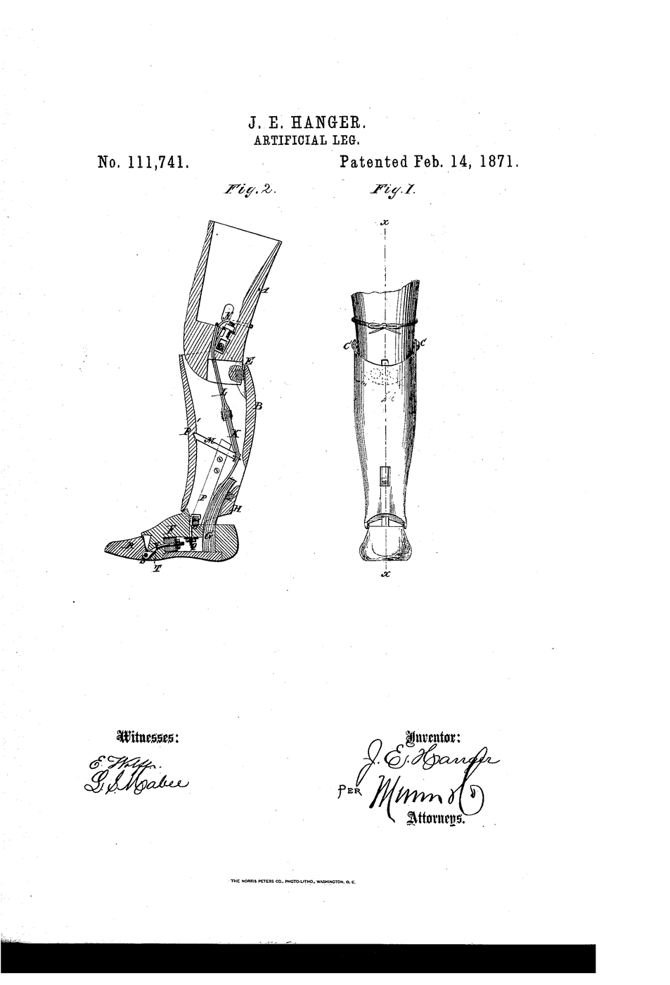 Artificial Leg