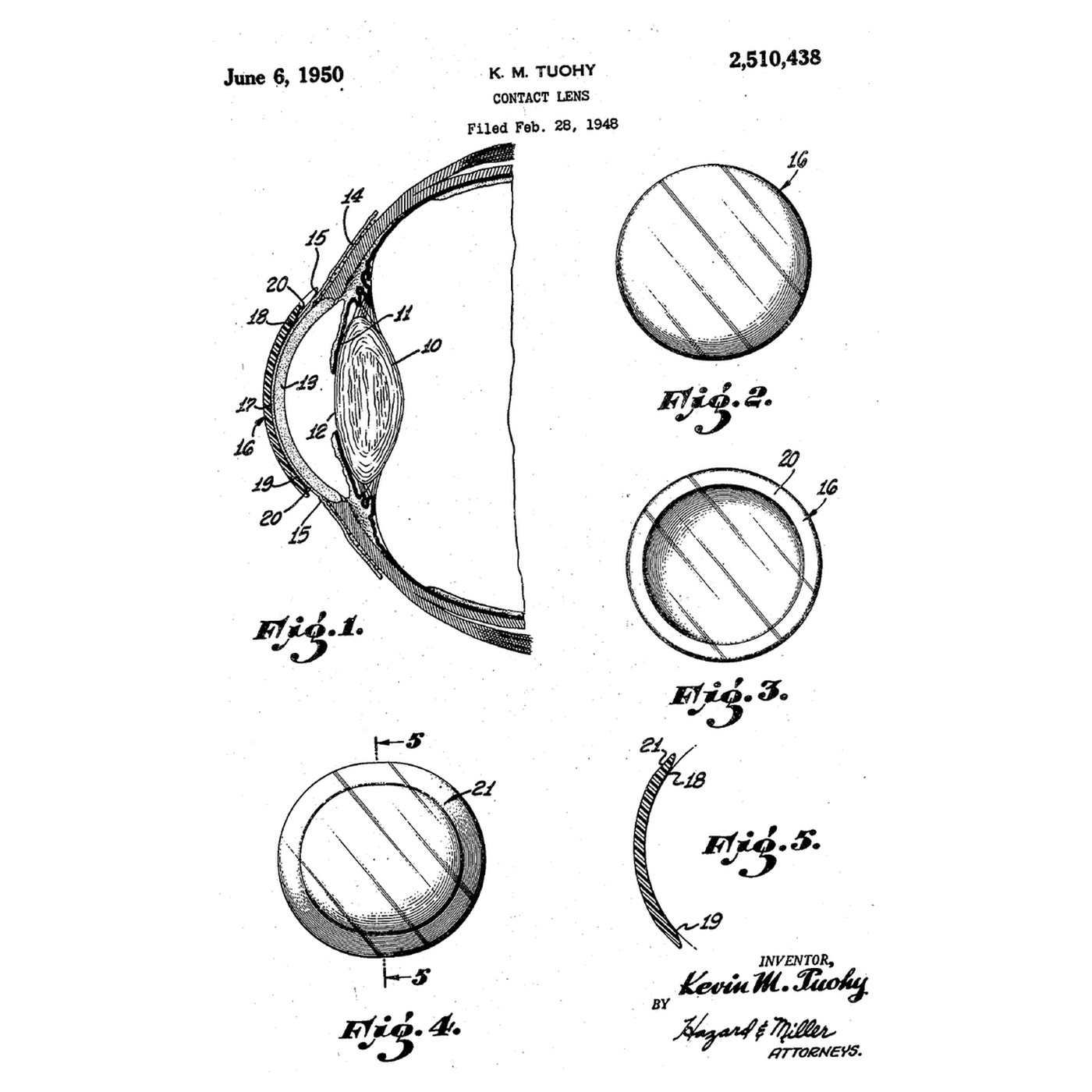 The Contact Lens: A Lens Floating on the Tears