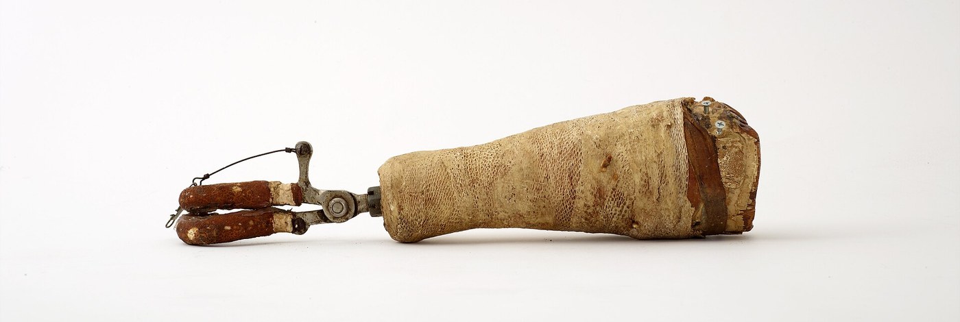 The Body-Powered Prosthetic Hand