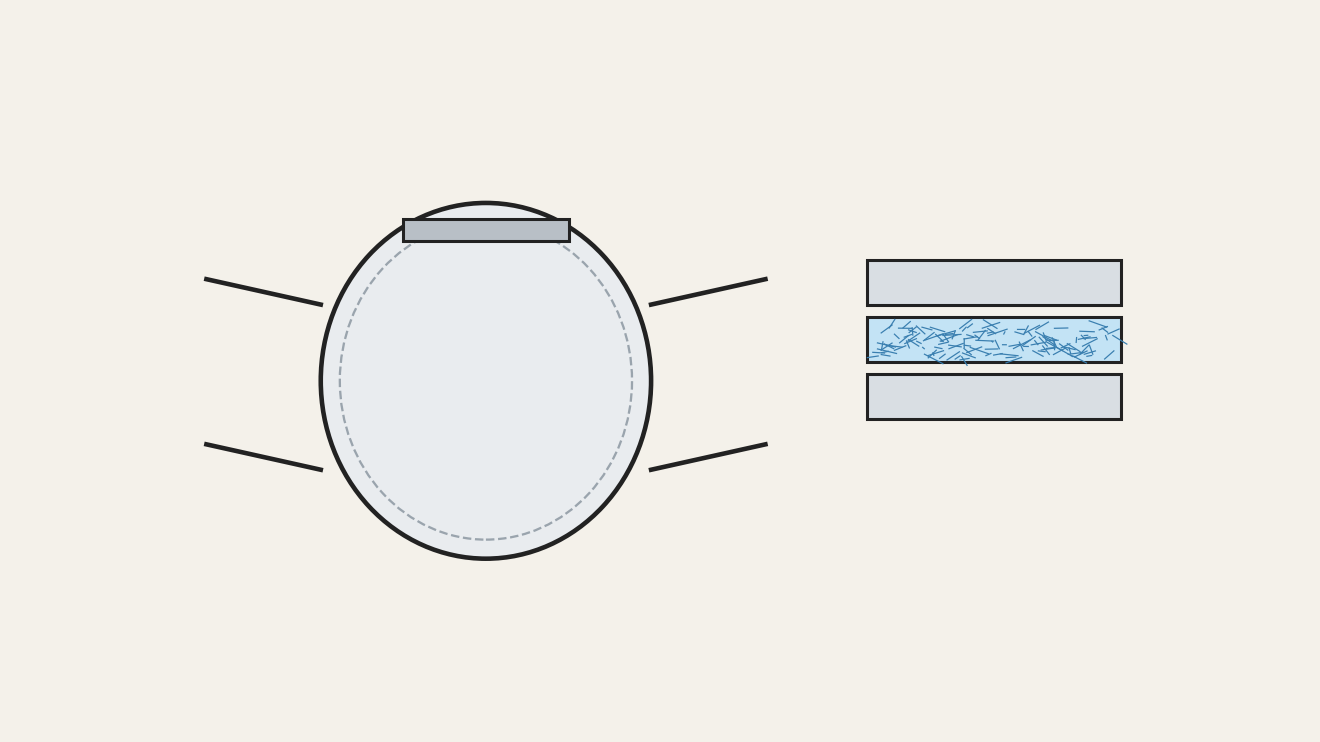 N95 Respirator: Melt-Blown, Charged and Welded