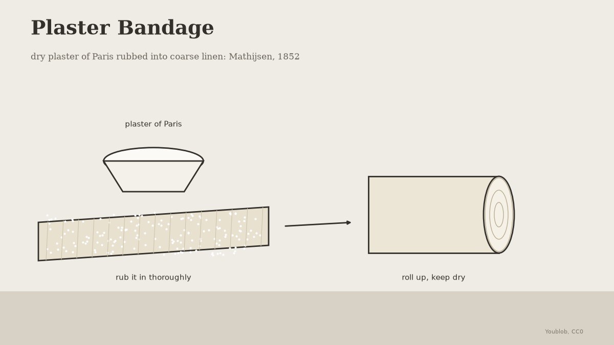 Plaster Bandage: Dry Plaster of Paris Rubbed into Coarse Linen, Mathijsen 1852
