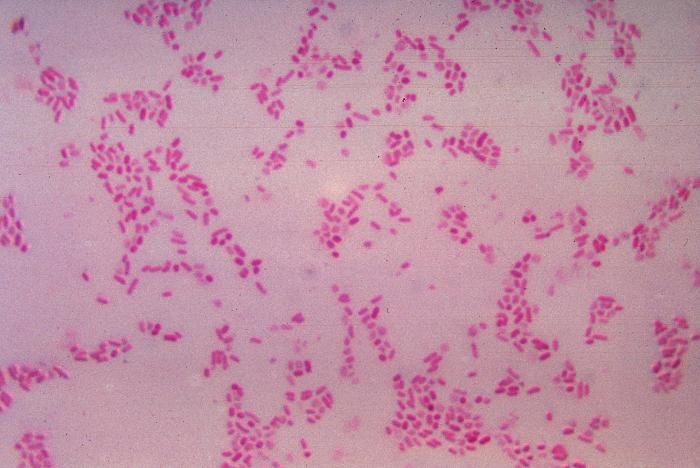 Staining: Making the Invisible Visible